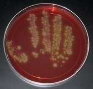 MRSA germ