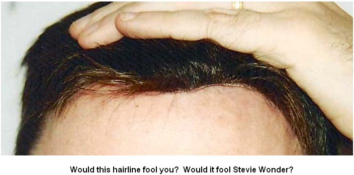 For Christians Messianic Jews Hair Club For Men And Women